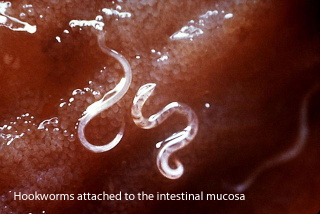 Illustration for article titled How to Kill a Parasitic Worm Living Inside of You